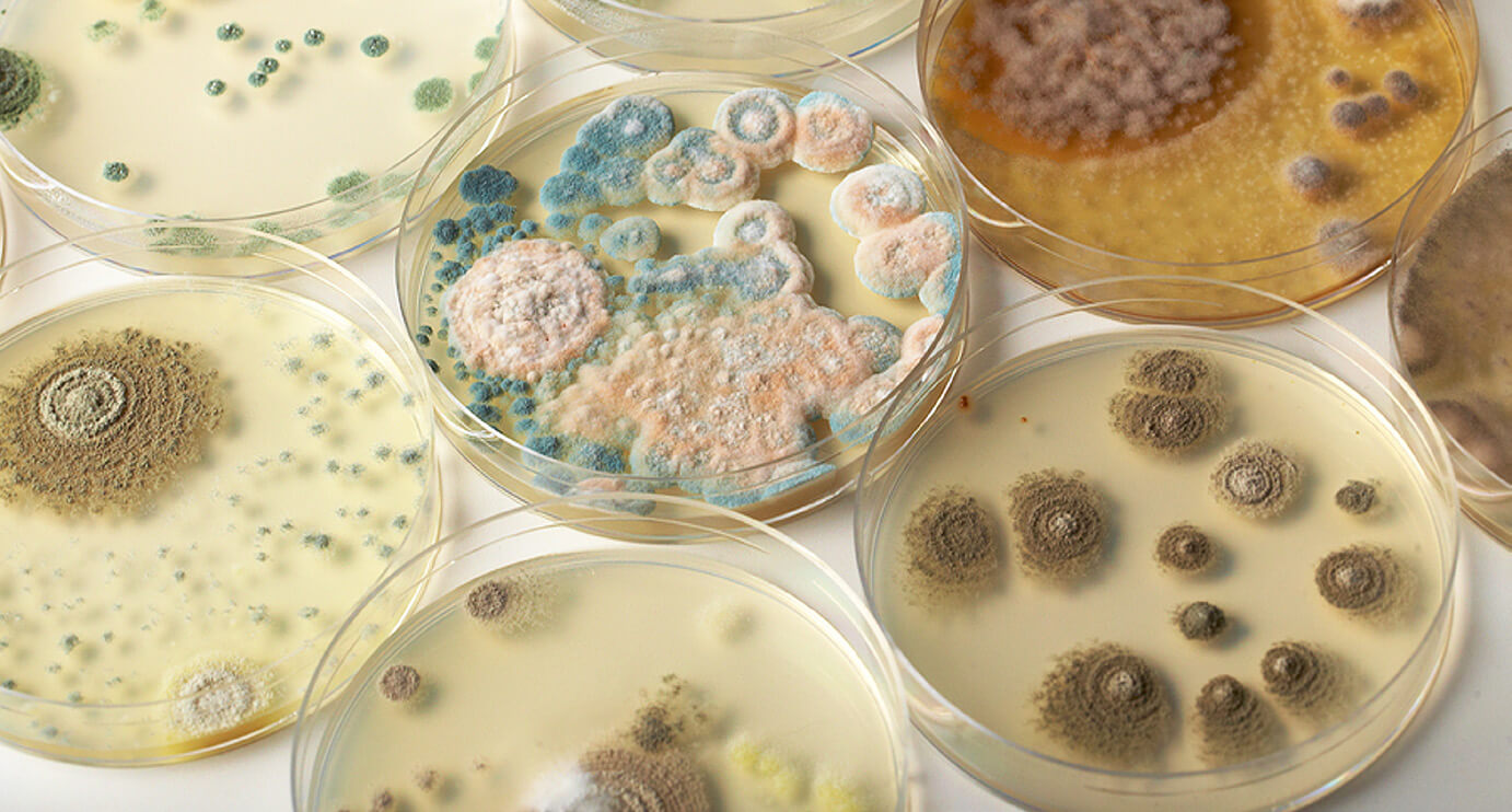 Фото Среды для определения микроскопических и дрожжеподобных грибов